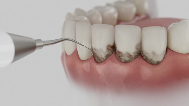 Reliable Dental Implants contractor in Daniels, WV by Smile Center Dentistry